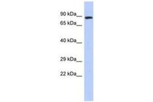 Image no. 1 for anti-Zinc Finger, FYVE Domain Containing 20 (ZFYVE20) (N-Term) antibody (ABIN6742873) (Rabenosyn 5 抗体  (N-Term))