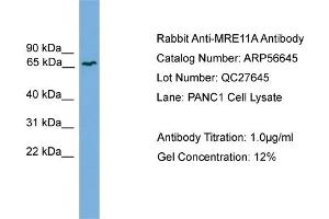 WB Suggested Anti-MRE11A  Antibody Titration: 0. (Mre11 抗体  (Middle Region))