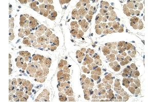 KLHL31 antibody was used for immunohistochemistry at a concentration of 4-8 ug/ml to stain Skeletal muscle cells (arrows) in Human Muscle. (KLHL31 抗体)