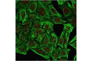 Immunofluorescent staining of methanol-fixed HeLa cells. (Cytokeratin 7 抗体)