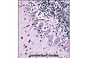 Immunohistochemistry (Paraffin-embedded Sections) (IHC (p)) image for anti-Transient Receptor Potential Cation Channel, Subfamily C, Member 5 (TRPC5) (AA 254-283), (N-Term) antibody (ABIN657691)