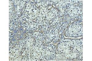 IHC analysis of COL4A2 using anti-COL4A2 antibody (ABIN7600234).