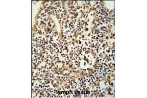 ANO5 Antibody (C-term) (ABIN652521 and ABIN2842350) immunohistochemistry analysis in formalin fixed and paraffin embedded human lymph tissue followed by peroxidase conjugation of the secondary antibody and DAB staining. (Anoctamin 5 抗体  (C-Term))