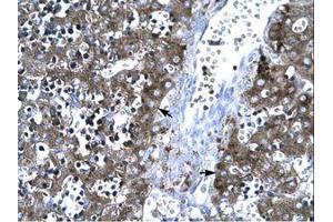 Image no. 3 for anti-Matrix Metallopeptidase 19 (MMP19) (AA 349-398) antibody (ABIN202685) (MMP19 抗体  (AA 349-398))