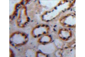 Used in DAB staining on fromalin fixed paraffin-embedded kidney tissue (PKC alpha 抗体  (AA 339-597))
