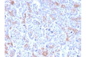 Immunohistochemistry (IHC) image for anti-ATP-Binding Cassette, Sub-Family C (CFTR/MRP), Member 3 (ABCC3) (AA 815-957) antibody (ABIN6940972)