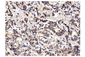 IHC analysis of PFKFB2 using anti-PFKFB2 antibody (ABIN7601627). (PFKFB2 抗体  (AA 4-505))