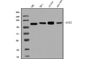 Western blot analysis of DGKZ/DGK-zeta using anti-DGKZ/DGK-zeta antibody (ABIN7602261).