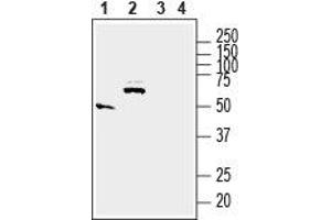 Western blot analysis of rat small intestine (lanes 1 and 3) and brain (lanes 2 and 4) lysates: - 1,2. (Solute Carrier Family 17 (Acidic Sugar Transporter), Member 5 (SLC17A5) (AA 479-492), (C-Term), (Intracellular) 抗体)