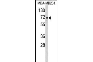 Western blot analysis of ARHG Antibody (Center) (ABIN652455 and ABIN2842309) in MDA-M cell line lysates (35 μg/lane). (ARHGAP18 抗体  (AA 180-207))