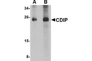 Western Blotting (WB) image for anti-LITAF-Like Protein (CDIP1) (Middle Region 1) antibody (ABIN1031187) (CDIP1 抗体  (Middle Region 1))