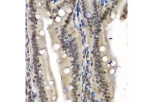Immunohistochemistry of paraffin-embedded mouse Intestine using NELFE antibody at dilution of 1:100 (x40 lens). (RDBP 抗体)