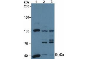 Western blot analysis of (1) Human A431 Cells, (2) Human HeLa cells and (3) Porcine Heart Tissue.