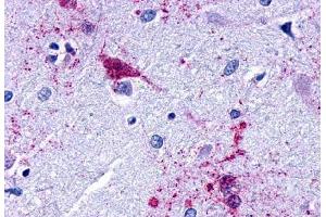 Anti-EDG7 antibody  ABIN1048536 IHC staining of human brain, amygdala. (LPAR3 抗体  (Cytoplasmic Domain))