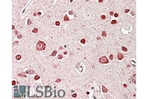 ABIN570996 (3. (STK39 抗体  (Internal Region))