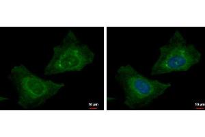 ICC/IF Image RABGGTB antibody detects RABGGTB protein at cytoplasm by immunofluorescent analysis. (RABGGTB 抗体)