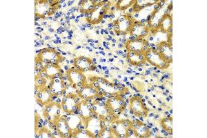 Immunohistochemistry of paraffin-embedded mouse kidney using TOMM20 antibody. (TOMM20 抗体  (AA 20-145))