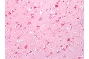 Human Brain, Cortex: Formalin-Fixed, Paraffin-Embedded (FFPE) (CNR1 抗体  (Cytoplasmic Domain))