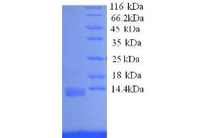 Interleukin 8 (IL8) (AA 23-101), (full length) protein (His tag) (IL-8 Protein (AA 23-101, full length) (His tag))