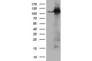 Western Blotting (WB) image for anti-Budding Uninhibited By Benzimidazoles 1 Homolog beta (Yeast) (BUB1B) antibody (ABIN1496997) (BUB1B 抗体)