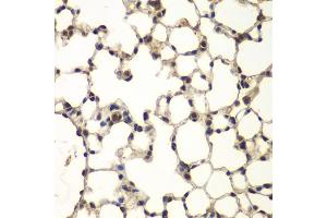 Immunohistochemistry of paraffin-embedded mouse lung using PHF11 antibody. (PHF11 抗体)