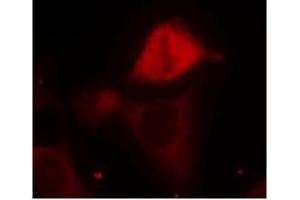 Image no. 1 for anti-Mitogen-Activated Protein Kinase Kinase 3 (MAP2K3) (pSer189) antibody (ABIN196862) (MAP2K3 抗体  (pSer189))