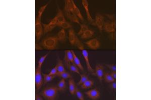Immunofluorescence (IF) image for anti-Lysyl-tRNA Synthetase (KARS) antibody (ABIN7268350)