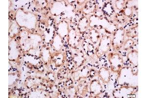 Immunohistochemistry (Paraffin-embedded Sections) (IHC (p)) image for anti-Solute Carrier Family 16 Member 2 (SLC16A2) (AA 101-200) antibody (ABIN1387834)