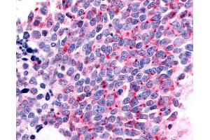 Immunohistochemistry (IHC) image for anti-Olfactory Receptor, Family 6, Subfamily K, Member 3 (OR6K3) (C-Term) antibody (ABIN1049186)
