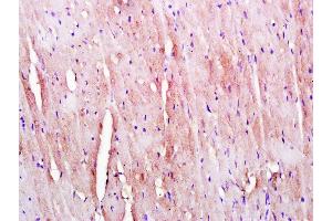 Paraformaldehyde-fixed, paraffin embedded Mouse heart, Antigen retrieval by boiling in sodium citrate buffer (pH6. (Kelch-Like 24 抗体  (AA 1-100))