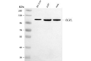 Western blot analysis of OCRL using anti-OCRL antibody (ABIN7599572).