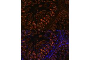 Immunofluorescence analysis of rat testis using FER1L5 antibody (ABIN7267166) at dilution of 1:100. (FER1L5 抗体  (AA 1350-1670))