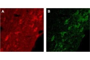 Expression of p75NTR in rat brain - Immunohistochemical staining of rat brain with Anti-p75 NGF Receptor (extracellular) Antibody (ABIN7043344, ABIN7044755 and ABIN7044756). (NGFR 抗体  (Extracellular, Stalk Region))