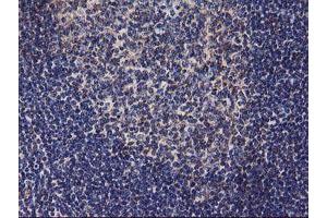 Image no. 3 for anti-Diacylglycerol Kinase, alpha 80kDa (DGKA) antibody (ABIN1497815) (DGKA 抗体)