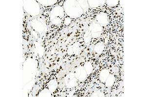 IHC analysis of KAP1/TRIM28 using anti-KAP1/TRIM28 antibody (ABIN7602310). (KAP1 抗体  (AA 699-835))