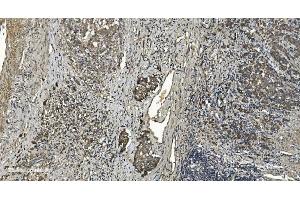 IHC analysis of RGS6 using anti-RGS6 antibody (ABIN7602326).