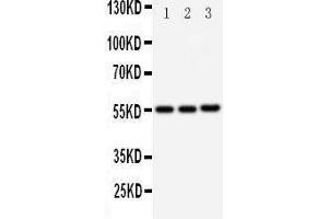 Western Blotting (WB) image for anti-Kallikrein 2 (KLK2) (AA 243-261), (C-Term) antibody (ABIN3043140) (Kallikrein 2 抗体  (C-Term))