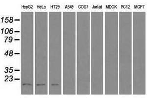 Image no. 2 for anti-Cancer/testis Antigen 1B (CTAG1B) antibody (ABIN1499904) (CTAG1B 抗体)