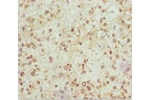 Immunohistochemistry (IHC) image for anti-NADH Dehydrogenase (Ubiquinone) Fe-S Protein 1, 75kDa (NADH-Coenzyme Q Reductase) (NDUFS1) (AA 80-290) antibody (ABIN7160986)