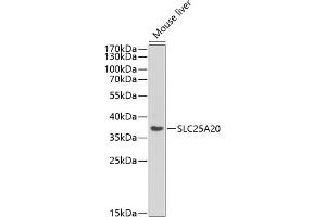 Western blot analysis of extracts of various cell lines, using SLC25 antibody (ABIN6129250, ABIN6147917, ABIN6147919 and ABIN6218142) at 1:440 dilution. (SLC25A20 抗体  (AA 1-301))