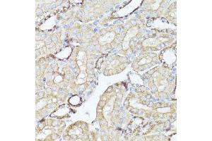 Immunohistochemistry (Paraffin-embedded Sections) (IHC (p)) image for anti-Opioid Receptor, kappa 1 (OPRK1) (C-Term) antibody (ABIN6145043)