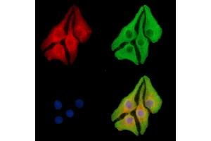SPNS1 Antibody staining Hela cells by IF/ICC. (SPNS1/Spinster 1 抗体)