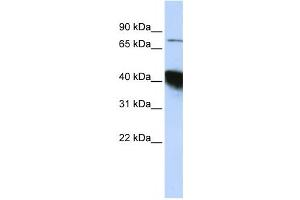 Western Blotting (WB) image for anti-CBP80/20-Dependent Translation Initiation Factor (CTIF) antibody (ABIN2458532)