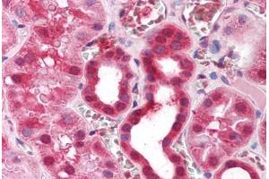 Immunohistochemistry (IHC) image for anti-Zinc Finger Protein 36, C3H Type, Homolog (Mouse) (ZFP36) (AA 84-133) antibody (ABIN214153)