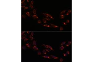 Immunofluorescence analysis of U-2 OS cells using NSDHL antibody (ABIN7268794) at dilution of 1:100. (NSDHL 抗体  (AA 1-240))