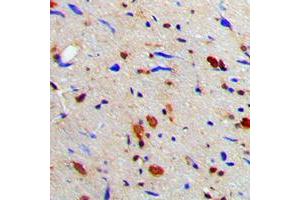 Immunohistochemical analysis of MGCRACGAP staining in human brain formalin fixed paraffin embedded tissue section. (RACGAP1 抗体  (N-Term))