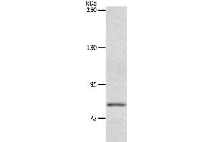 Western Blot analysis of Mouse liver tissue using ABCB6 Polyclonal Antibody at dilution of 1:250 (ABCB6 抗体)