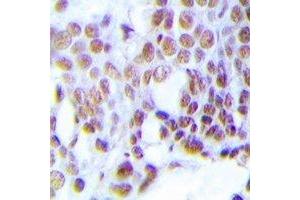 Immunohistochemistry (IHC) image for anti-O6-Methylguanine-DNA-Methyltransferase (MGMT) (N-Term) antibody (ABIN7303828)