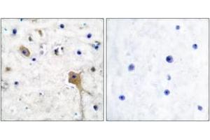 Immunohistochemistry analysis of paraffin-embedded human brain tissue, using SH-PTP2 Antibody. (PTPN11 抗体  (AA 321-370))