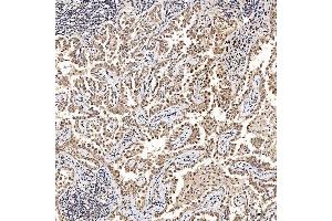 IHC analysis of SAE1 using anti-SAE1 antibody (ABIN7601346).